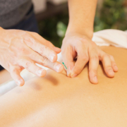 Acupuncture and Oncology